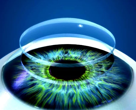 cornea