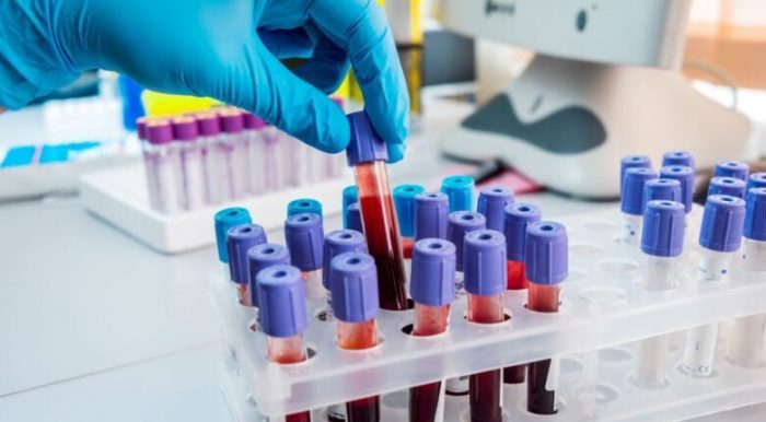 laboratori-analisi