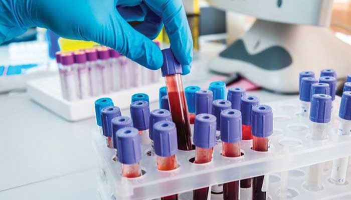 laboratorio_analisi