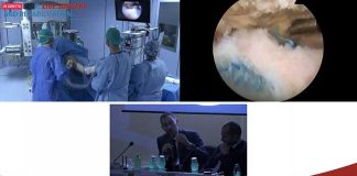 Formazione – In 100 entrano in sala operatoria grazie al Live Surgery