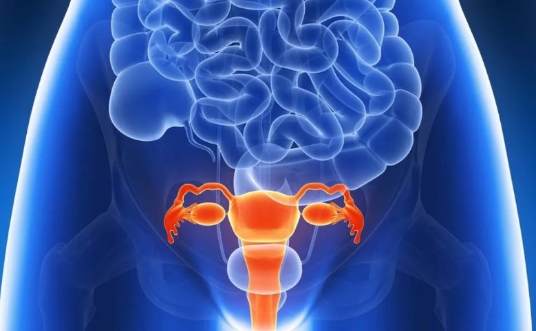 endometriosi