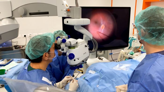 Oculistica, al Policlinico di Bari oltre 4.200 interventi nei primi sei mesi del 2025